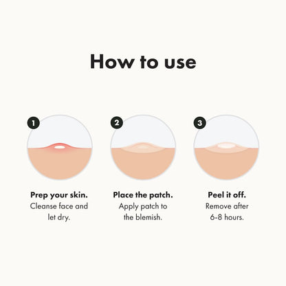 Fame Aura™ Dots for Spots – Pimple Patches
